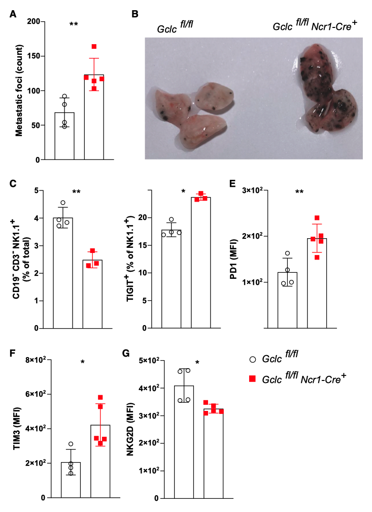 Glutathione supports control of metastatic tumor spread mediated by NK cells in vivo Glutathione supports control of metastatic tumor spread mediated by NK cells in vivo