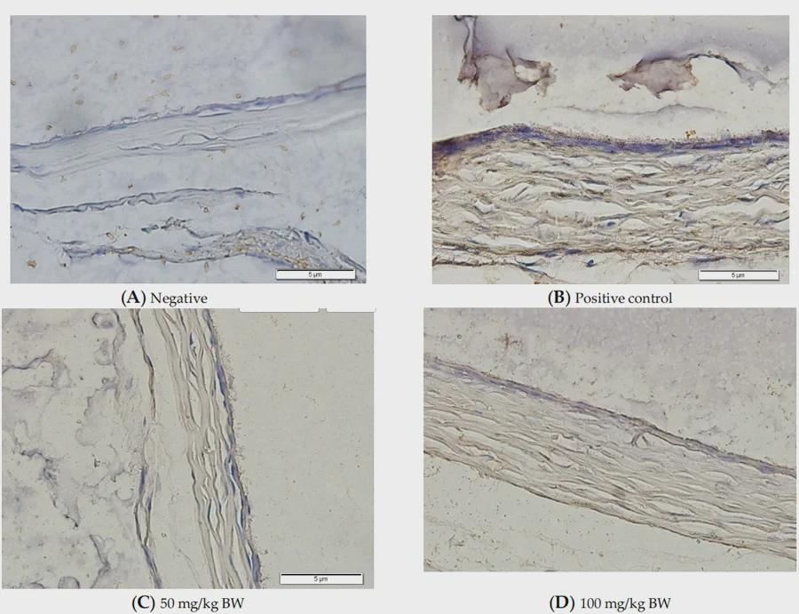 expression changes of MMP-2 expression changes of MMP-2