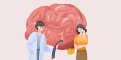 Citicoline improves your brain function - cerebrovascular disease