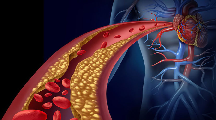 Japan completes clinical trials of NMN intravenous injection