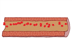 Treatment of cerebrovascular diseases with citicoline and cerebral actin