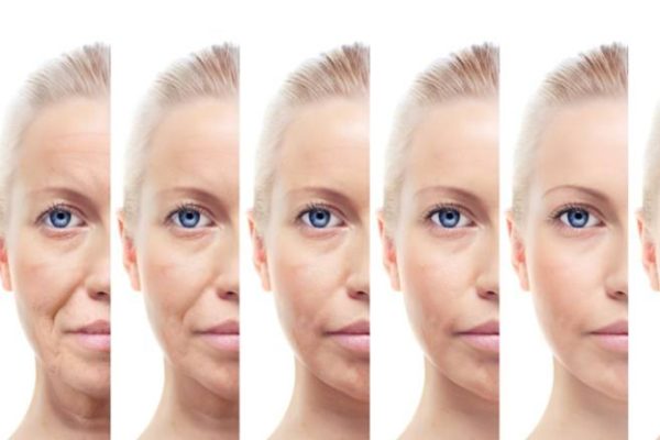 How does NMN help menopausal women say goodbye to menopause troubles