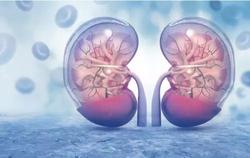 NMN reduces acute kidney injury associated with sepsis